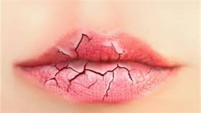 احذري تغييرات الشفاه.. تنذر بمشكلات صحية