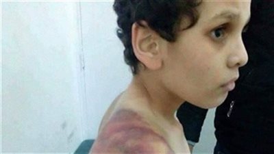  الحكم على ربة منزل عذبت ابن زوجها بالشروق