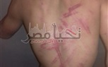 بالصور.. أمن القليوبية ينجح فى تحرير 4 مختطفين بعد تعذيبهم بالكهرباء 