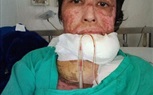 بالصور.. زوج يحرق زوجته بالبنزين بسبب صورة سيلفى