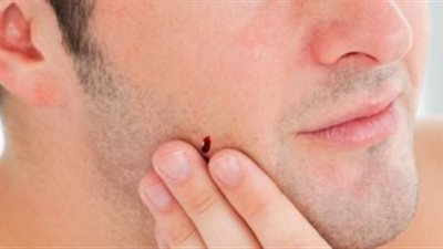 للرجال فقط.. 5 وصفات طبيعية لتهدئة جروح ما بعد الحلاقة